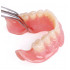 Приварка зуба на протез